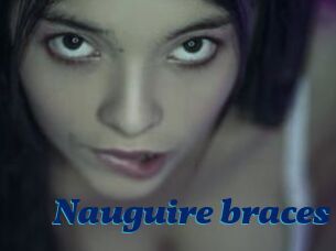 Nauguire_braces
